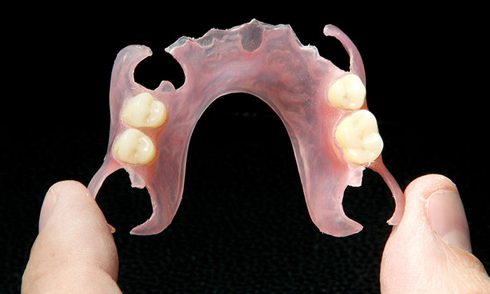 関内歯科クリニックの入れ歯治療